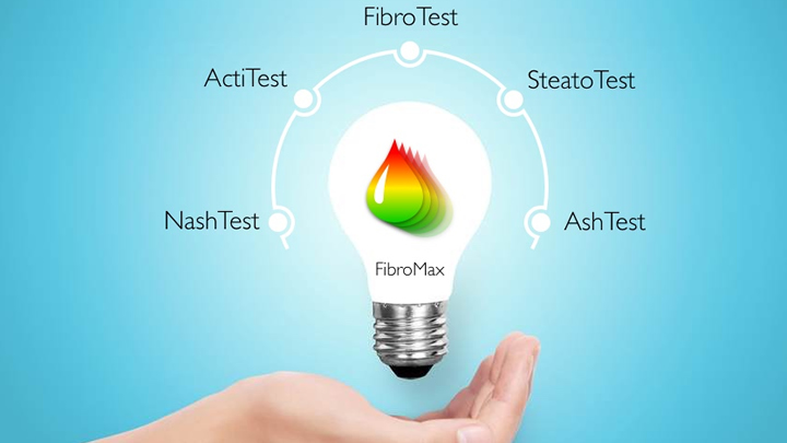 Eficacia del FIBROMAX para el diagnóstico de Enfermedad por Hígado Graso No Alcohólico