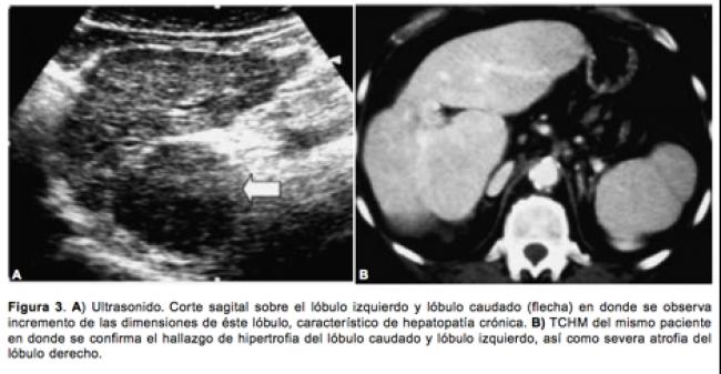 estudios de imagen 11