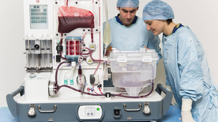 El respirador artificial que promete revolucionar los trasplantes