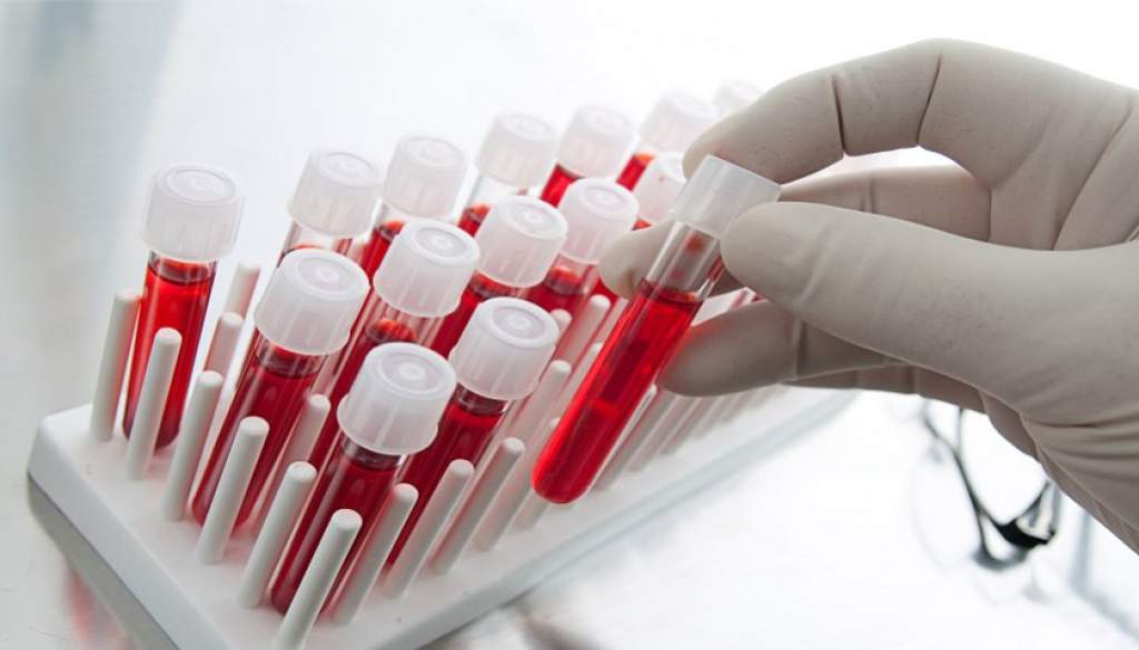 NOVEDOSO SISTEMA PARA LA PREDICCIÓN DE LA LESIÓN HEPÁTICA INDUCIDA POR FÁRMACOS