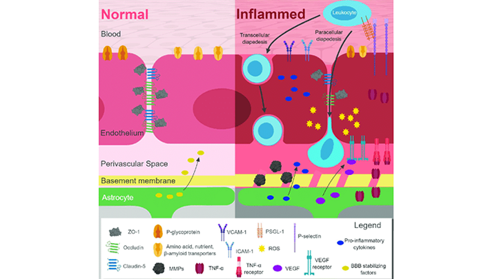 HÍGADO METABÓLICO INDUCE INFLAMACIÓN CEREBRAL SIMILAR A ALZHEIMER