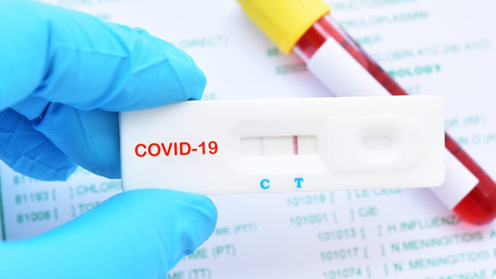 UTILIDAD DE MEDIR ANTICUERPOS CONTRA INFECCIONES